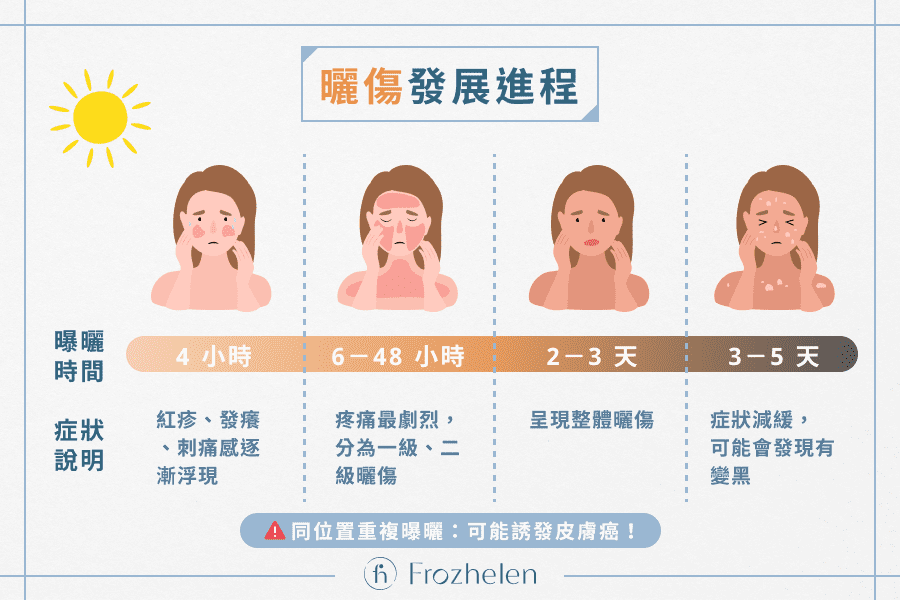 曬傷發展進程