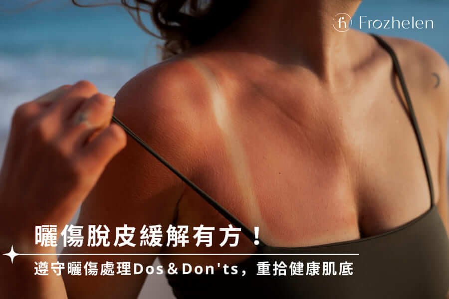 曬傷脫皮緩解有方！遵守曬傷處理Dos＆Don'ts，重拾健康肌底